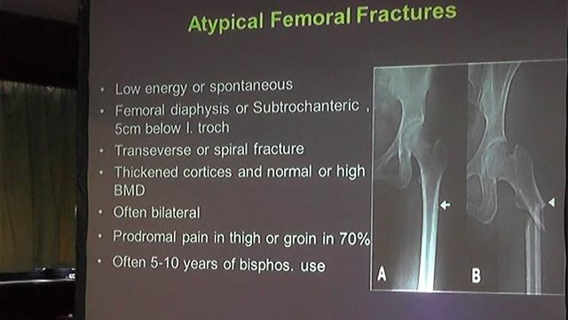 Osteoporosis Antiresorptive agents in OP Henaz Farouk ERG Safwat El Araby смотреть онлайн