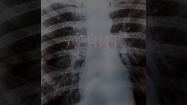 9 причин ежедневно употреблять чеснок натощак смотреть онлайн