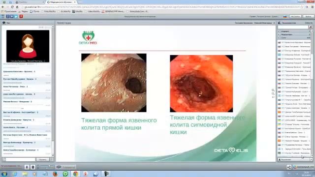 Язвенный колит Д р Баранова Т Н смотреть онлайн