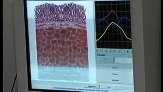 Описание ИМАГО теста смотреть онлайн