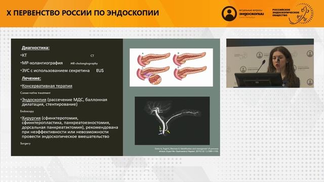 PANCREAS DIVISUM, ПРОБЛЕМА ДЕТСТВА? смотреть онлайн
