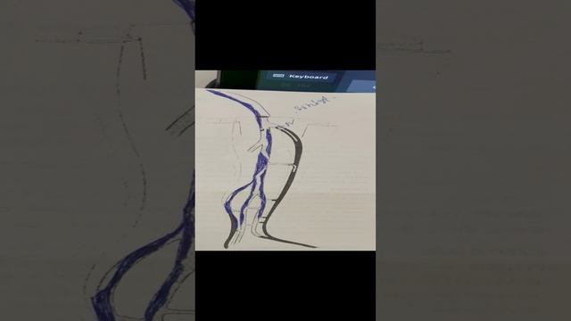 Лечение тромбоза. Узи сосудов. Флеболог Москва. Сосудистый хирург Москва смотреть онлайн