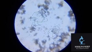 Грязь под ногтями под микроскопом