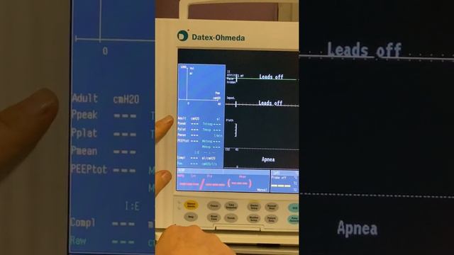 La spirometria nel monitor Datex Ohmeda S/5 compact, come impostarla e dove trovarla. смотреть онлайн