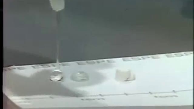 Polycarboxylate Cement (Durelon) смотреть онлайн