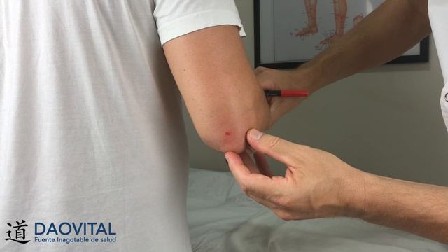PUNTO 10 del SAN JIAO - 天井 - tiān jĭng │ disuelve los nódulos de las axilas y del cuello смотреть онлайн