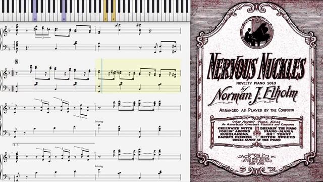 Nervous Nuckles by Norman Elholm (1923, Novelty Fox Trot) смотреть онлайн