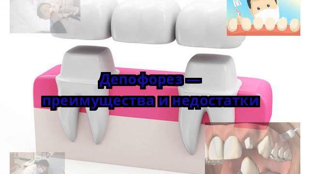Депофорез — преимущества и недостатки смотреть онлайн