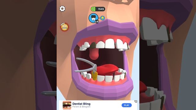 КАК ВЫЛЕЧИТЬ ЗУБЫ? ОТ НУБА ДО ПРО! Игра Dentist Bling смотреть онлайн