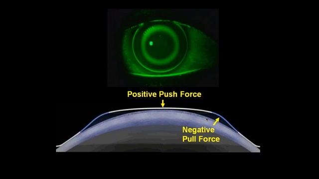 Differentiating Your Practice with Specialty Contact Lenses смотреть онлайн
