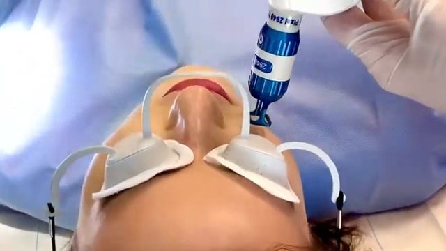 Skuteczne odmładzanie laserem Alma Harmony iPixel - zobacz film смотреть онлайн