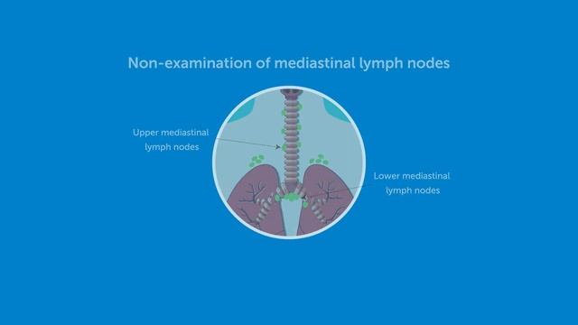Surgeon Quality and Patient Survival After Resection for Non–Small-Cell Lung Cancer смотреть онлайн