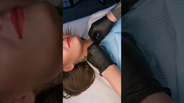 Установка микродермала смотреть онлайн