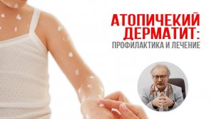 Атопический дерматит: профилактика и лечение