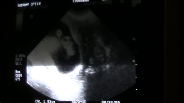 Stein baby смотреть онлайн