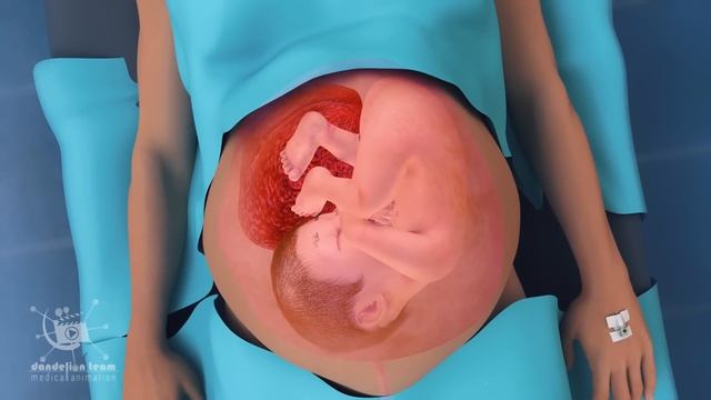 A cesarean section | known as a C-section | is a surgery to deliver a baby via the abdomen смотреть онлайн