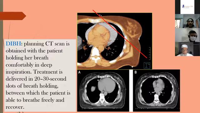 Breast Cancer Management What we need to know?- Patient Selection and Treatment Discussion смотреть онлайн