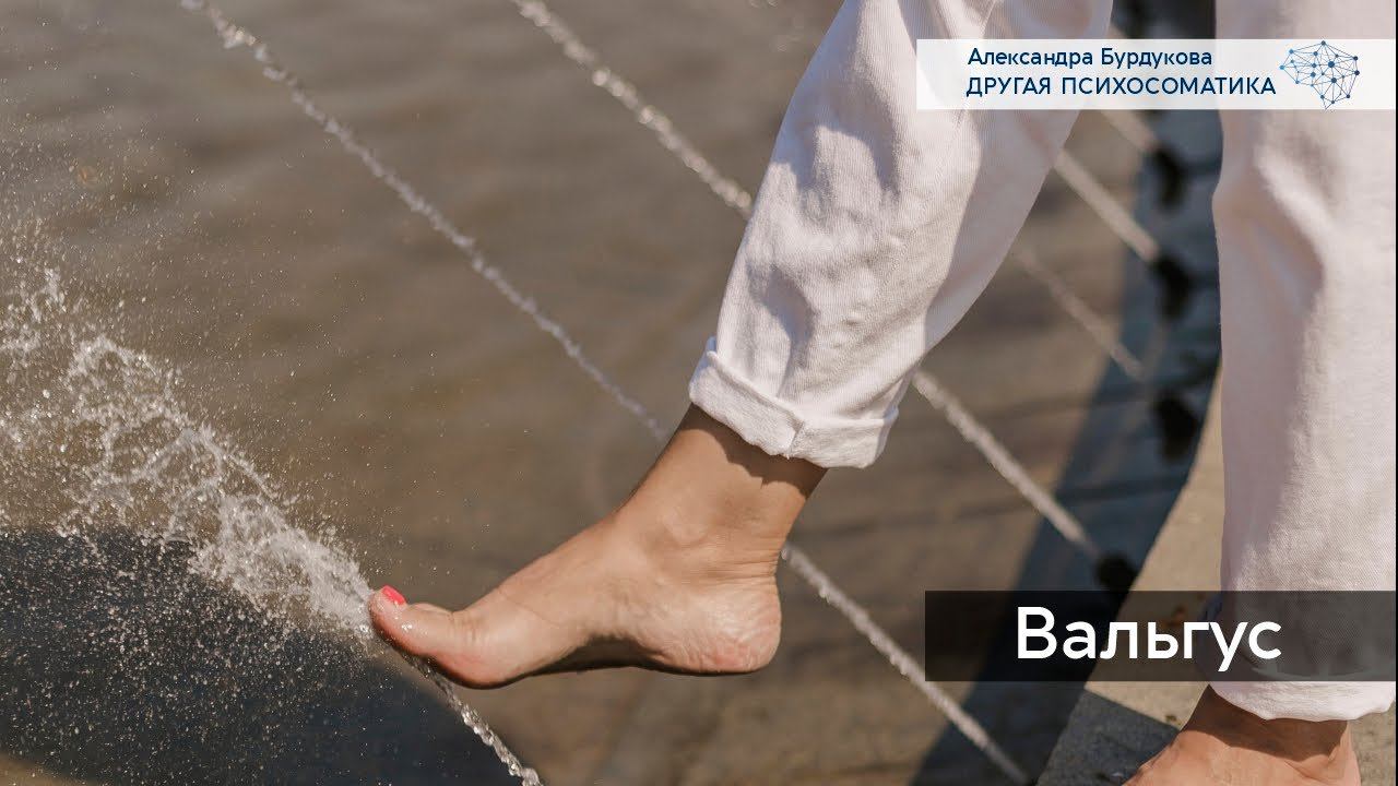 Вальгус. Психосоматика болезни. Другая психосоматика.