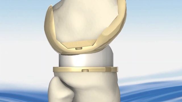 EnduRo™ Rotating Hinge Knee System Assembly смотреть онлайн