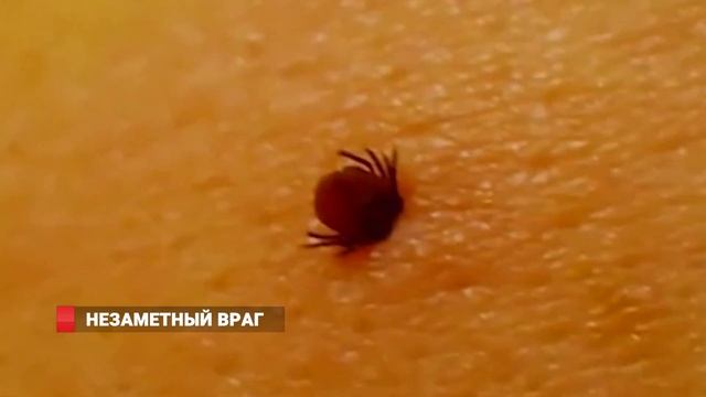НЕЗАМЕТНЫЙ ВРАГ: Что делать, чтобы не укусил клещ смотреть онлайн