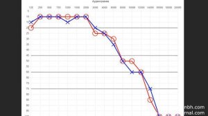 Смысл аудиограммы и алгоритм работы слухового аппарата, АЧХ. Практика. Исправления слуха