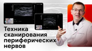 УЗИ периферических нервов верхних конечностей на Siemens NX3 Elite