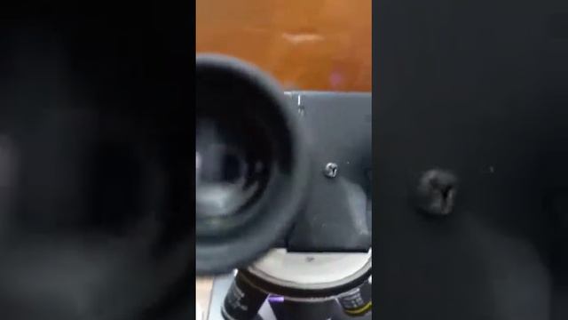 CBC SLIDE TEST IN MICROSCOPE #NICE PATHOLOGY LAB смотреть онлайн
