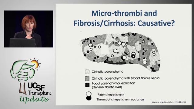 Anticoagulation for Portal Vein Thrombosis: Pros and Cons смотреть онлайн