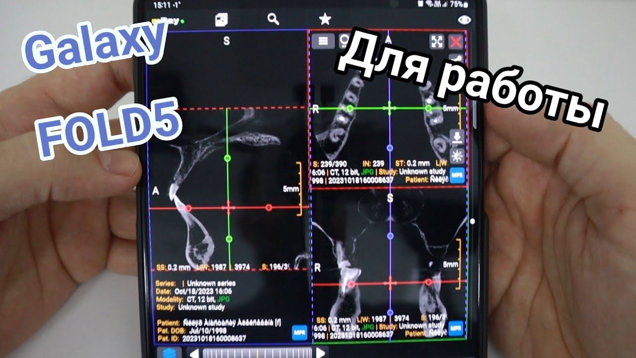 GALAXY FOLD 5. ХОРОШИЙ, НО ЗАЧЕМ ОН МНЕ?