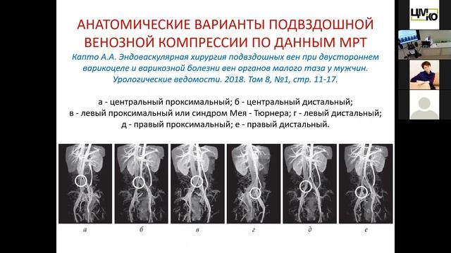 МРТ и КТ диагностика сосудистой патологии в урологии, андрологии и гинекологии. смотреть онлайн