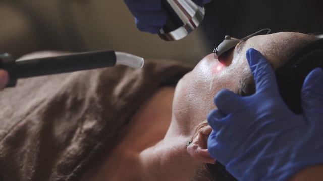 Microlaser Peel - лазерный пилинг в Набережных Челнах смотреть онлайн