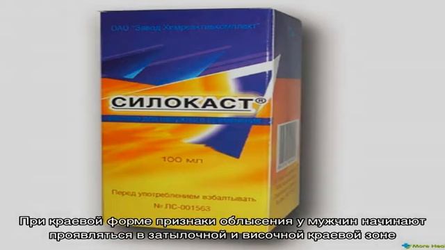 Облысение у мужчин. Как его предотвратить и что делать при облысении? смотреть онлайн