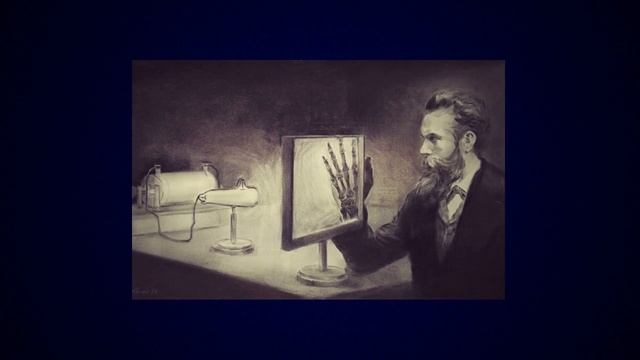 ПЕРВЫЙ НОБЕЛЕВСКИЙ ЛАУЕРАТ В ОБЛАСТИ ФИЗИКИ | РЕНТГЕНОВСКОЕ ИЗЛУЧЕНИЕ | ВИЛЬГЕЛЬМ РЕНТГЕН 1901 ГОД смотреть онлайн