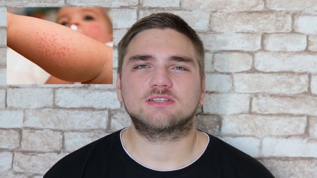 Менингит | Первые симптомы | Как защитить себя от менингита?