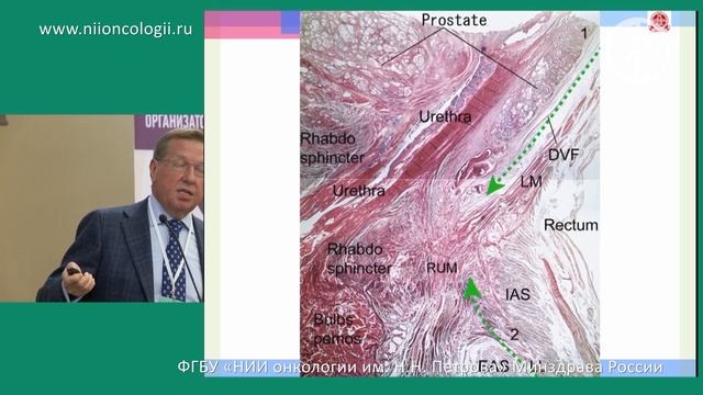 Анатомия прямой кишки как основа концепции ТМЕ смотреть онлайн