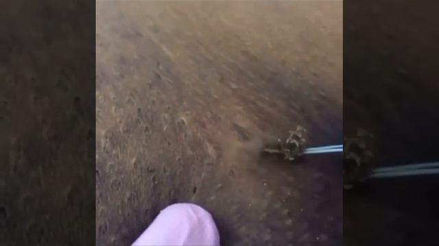 Вросший волос #shorts #вросшийволос #акне