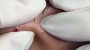 BESTПРЫЩ/ ДАВИМ КУЧУ ЧЕРНЫХ ТОЧЕК