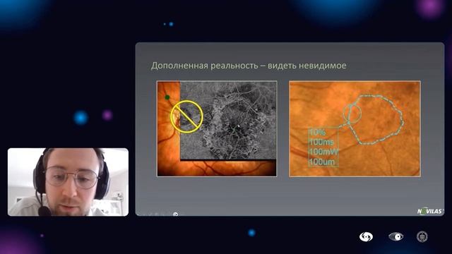 Место навигации и ай-трекинга в современной офтальмологии смотреть онлайн