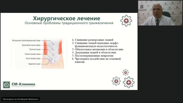 Вебинар "Грыжи белой линии живота" – Сенько.В.В. смотреть онлайн
