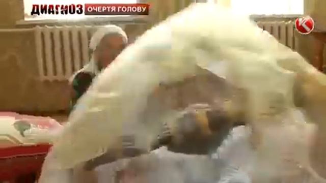Микроцефалия,Гидроцефалия смотреть онлайн