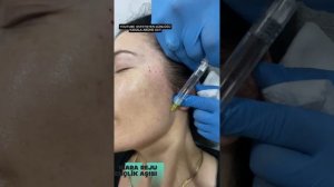 KİARA REJU (GENÇLİK AŞISI