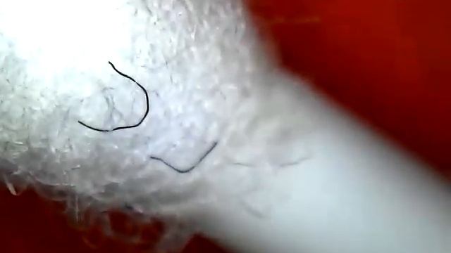 черные ворсинки шевелятся от дыхания смотреть онлайн