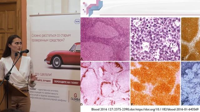 Сенченко М А Классификация ВОЗ 2016 Новые нозологические формы смотреть онлайн