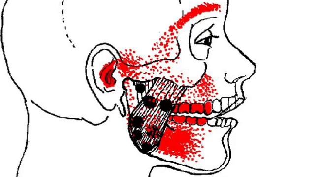Тревел и Симонс, ТОМ 1, Глава 8. Жевательные  мыщцы. ДВНЧС