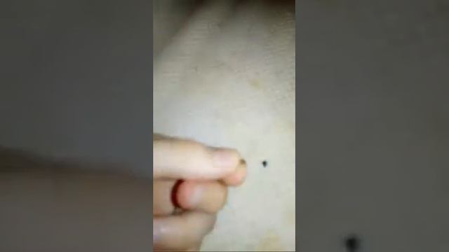 ВЫПЛ МАЛЕНЬКИЙ КУСОК ЗУБА!!😨😱😱😱😵😵😵😵😵😰😢😩😩😨😣 смотреть онлайн