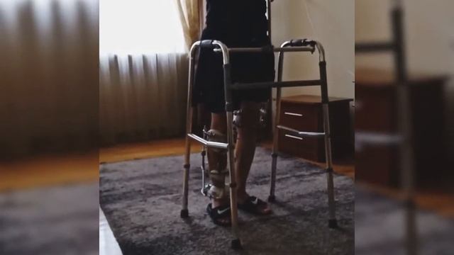 С аппаратом Илизарова упражнения на стабилизацию смотреть онлайн