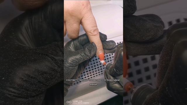 Аппаратное снятие