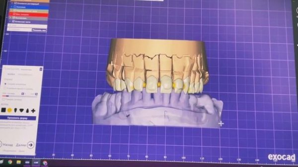 MASTER DENTAL STUDIO ( 3D Моделирование зубов )