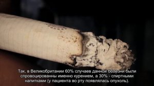 Ученые: Онемение губ может быть признаком развития рака ротовой полости