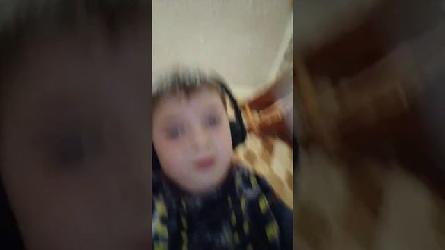 Гипс смотреть онлайн